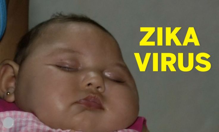 Zika Virus, Microcephaly and India